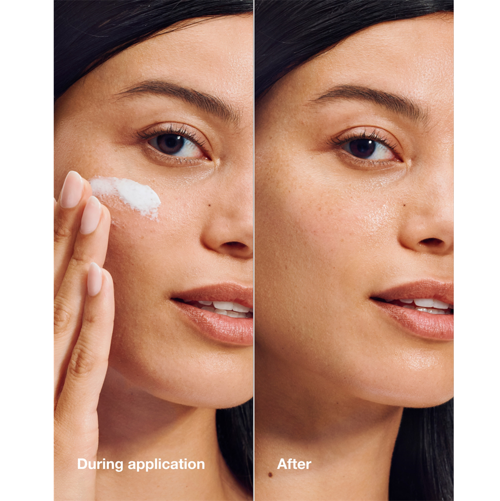 Before and after application of a skincare product on a woman's face.