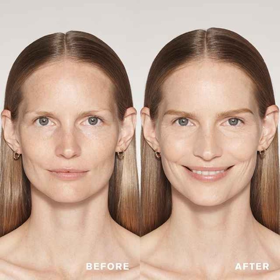 Before and after comparison of a woman's face with visible skin improvement.