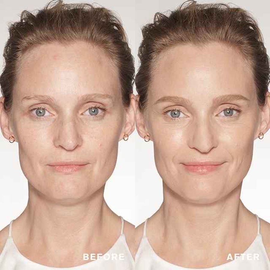 Before and after comparison of a woman's face on a white background