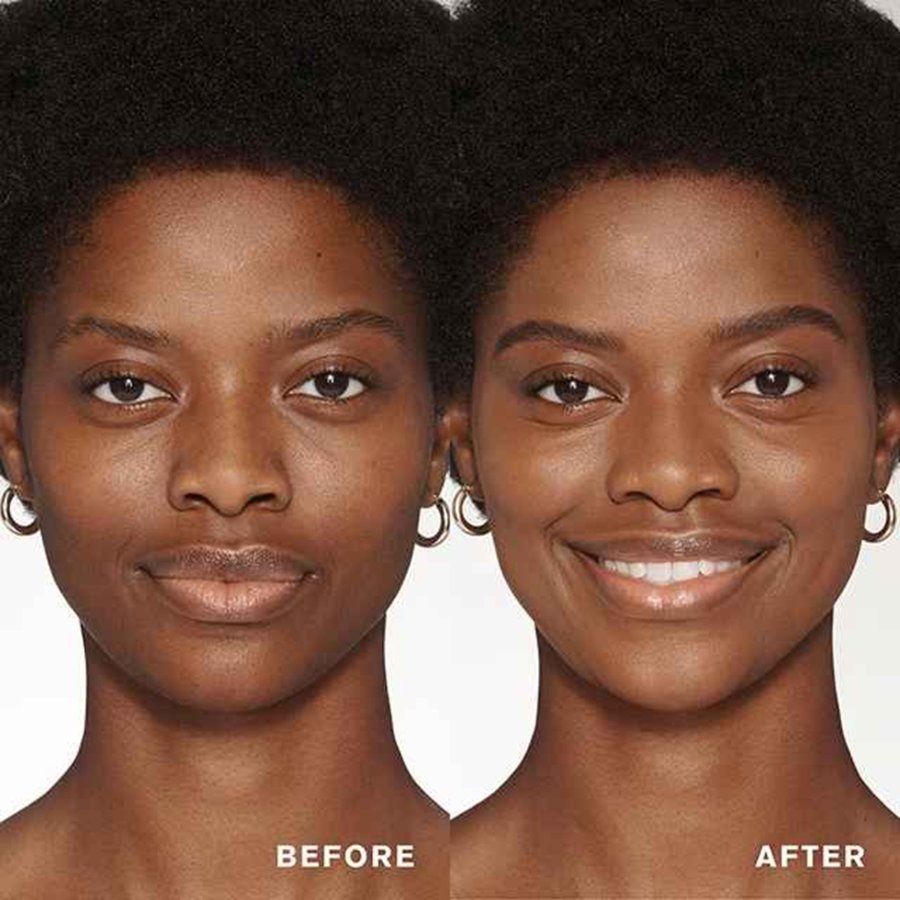 Before and after comparison of a woman's face with 'Before' on the left and 'After' on the right.